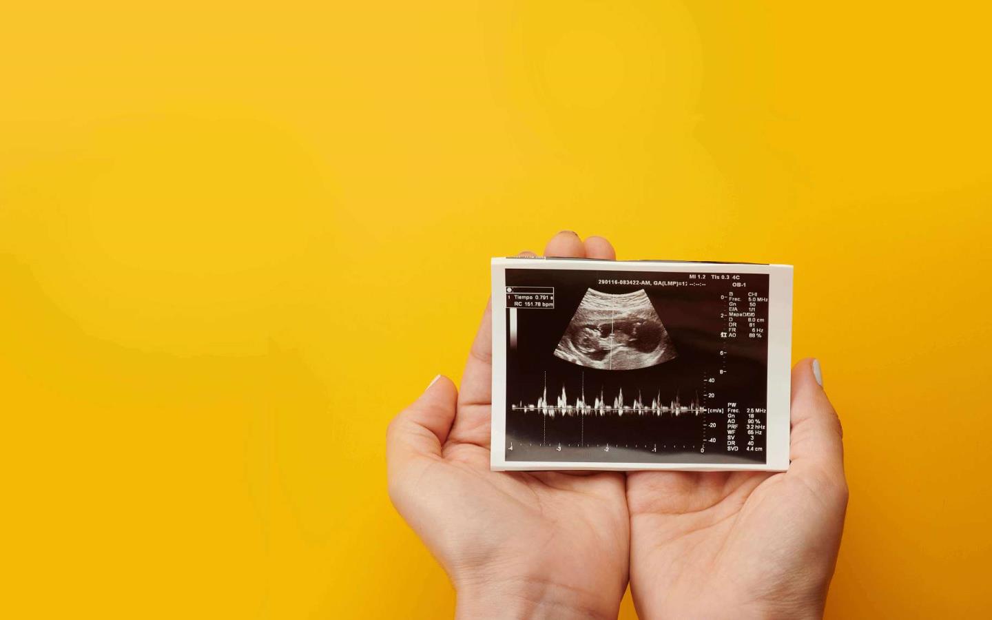 ULTRASOUNDS